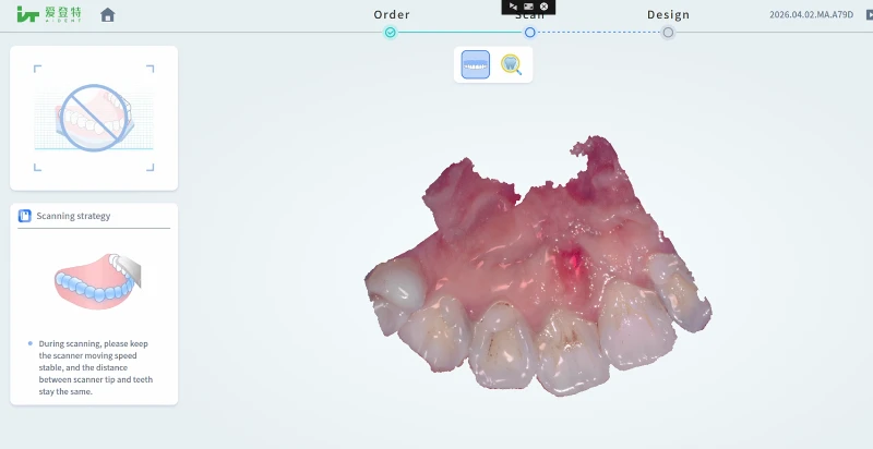 AI-30 intraoral scanner clinical application powder-free true-color scanning digital dentistry Turkey market AI-30 intraoral scanner clinical application powder-free true-color scanning digital dentistry Turkey market